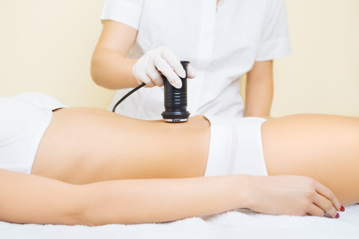 UltraShape and Liposonix: Reviewing Noninvasive Ultrasonic Lipolysis